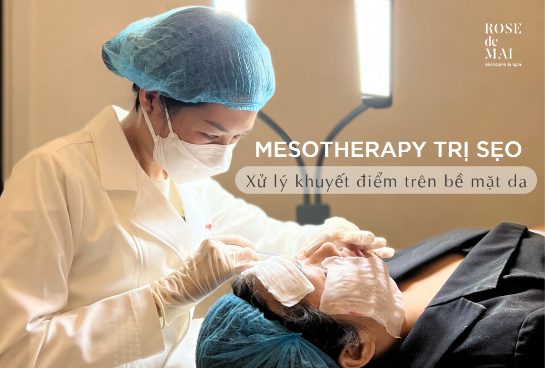 Mesotherapy trị sẹo - Xử lý khuyết điểm trên bề mặt da